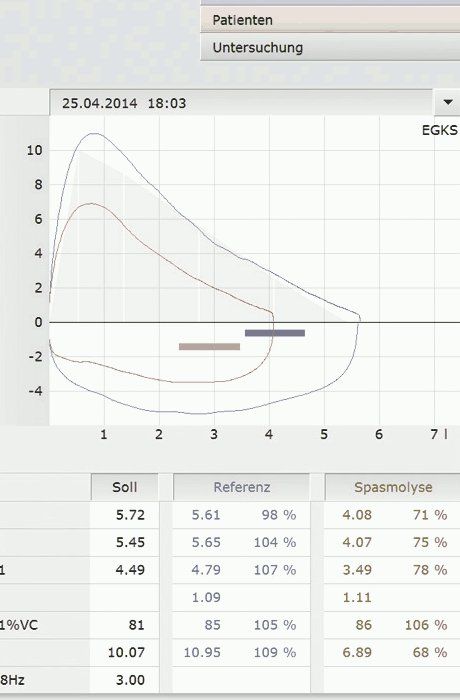 hmh medikal customed spirometre yazilim